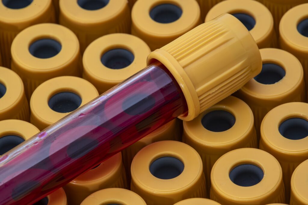 Blood testing